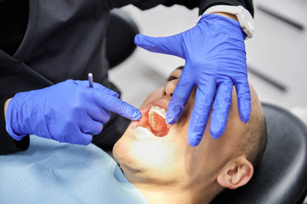 Best Emergency Treatment for Dental Infections or Abscesses in South Lockport, NY